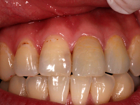 審美歯科治療 - 亀戸デンタルオフィス（江東区亀戸）